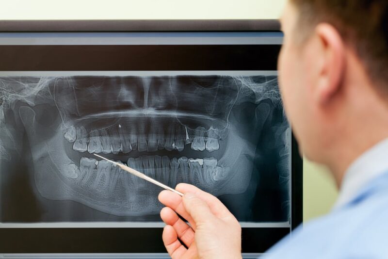 Digital Radiography • Ashland Family & Implant Dentistry